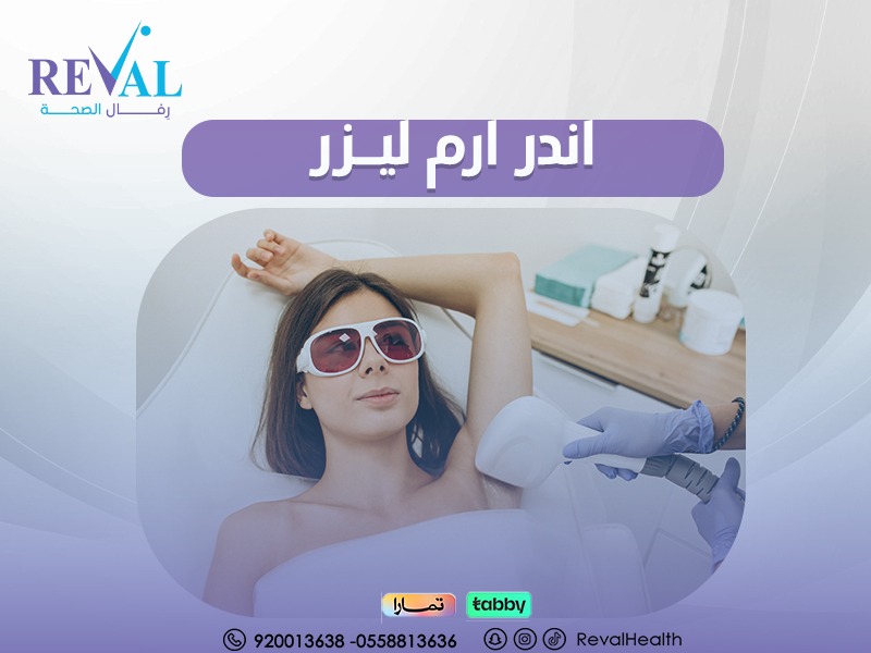 جلسة ليزر اندر ارم بالرياض: الحل الأمثل لإزالة شعر الإبط بشكل دائم 2025