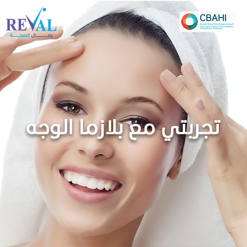 تجربتي مع  جلسة بلازما للوجه plasma-facial-session