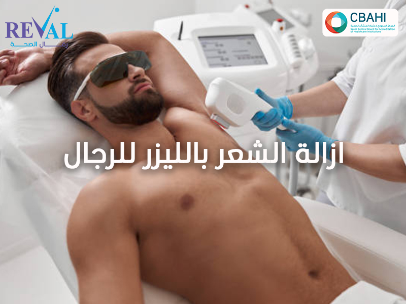 إزالة الشعر بالليزر للرجال