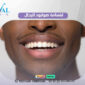 بتسامة هوليود للرجال Hollywood Smile for Men  85x85