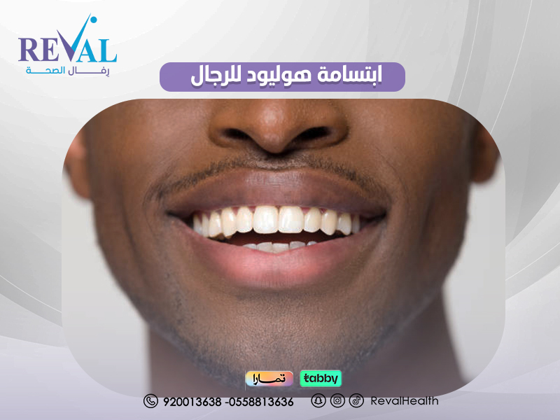 ابتسامة هوليود للرجال Hollywood Smile for Men  