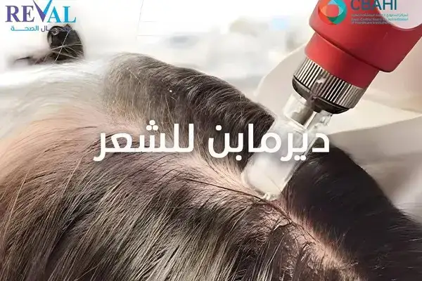 تجربتي مع دريما بن للشعر Dermapen for hair