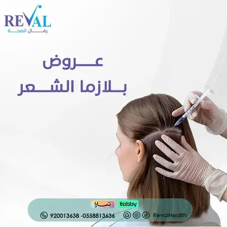 عروض بلازما الشعر عروض بلازما الشعر في الرياض hair-plasma-offers-riyadh