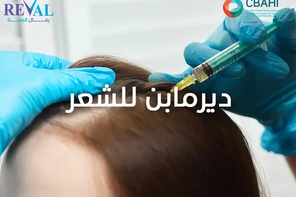 فوائد دريما بن للشعر Dermapen for hair لتساقط الشعر وعلاج الثعلبة