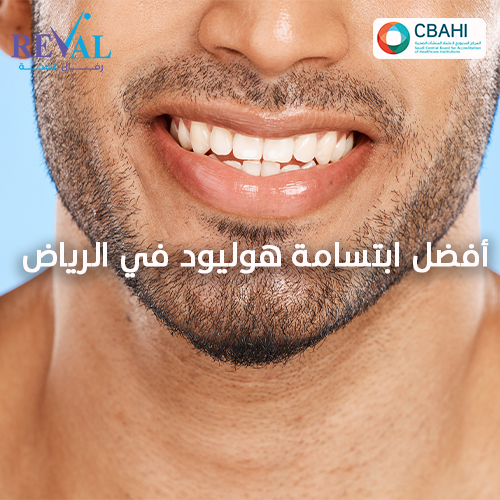 مزايا ابتسامة هوليود للرجال Hollywood Smile for Men  