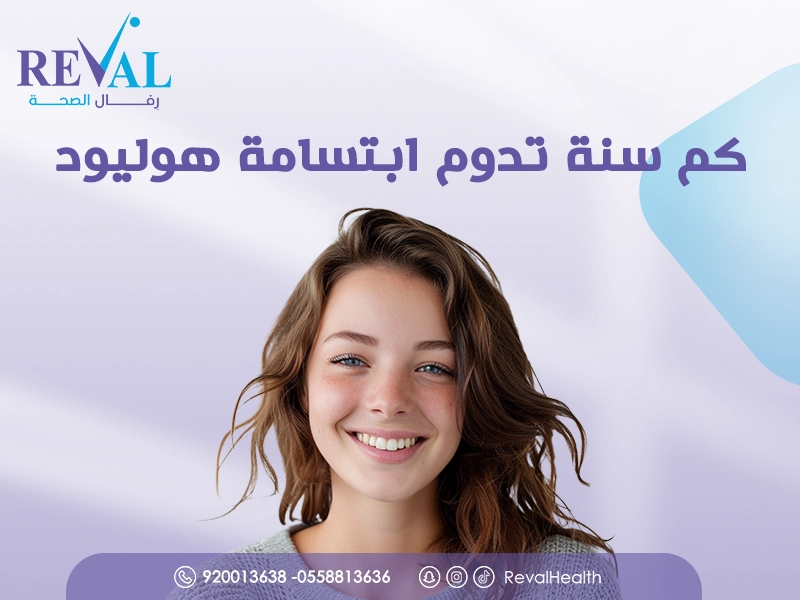 كم سنة تدوم ابتسامة هوليود؟ وكيف تحافظ عليها لأطول فترة ممكنة؟