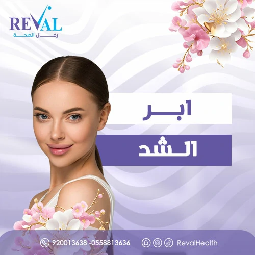 تجربتي مع  ابر الشد بالرياض