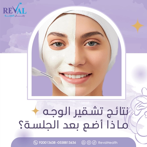 تجربتي مع تشقير الوجه بالليزر