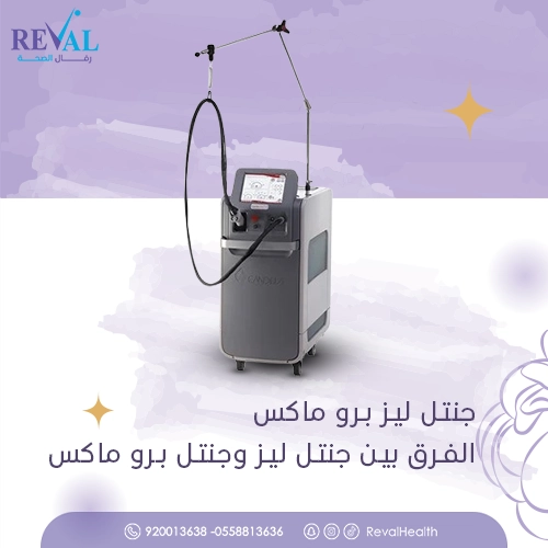 جنتل ليز برو ماكس – الفرق بين جنتل ليز وجنتل برو ماكس