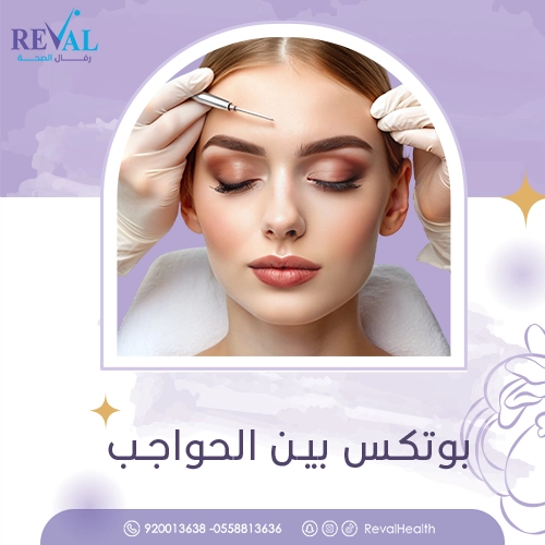 تجربتي مع بوتكس بين الحواجب