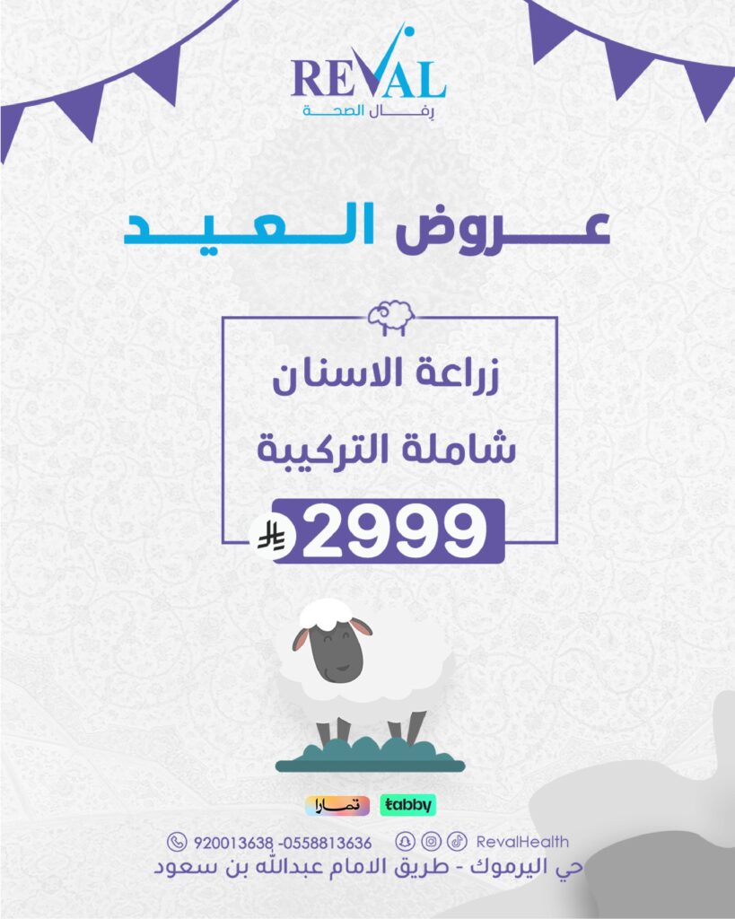 عروض زراعة الاسنان في عيد الاضحى