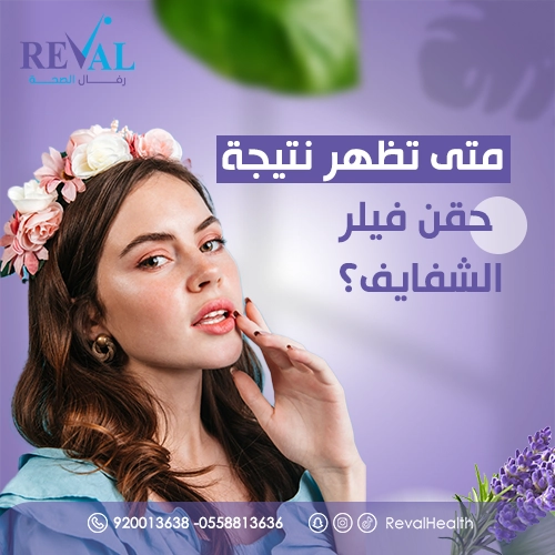 نصائح بعد حقن فيلر الشفايف