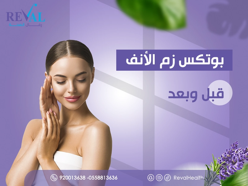 بوتكس زم الانف في الرياض: اسرار بوتوكس الأنف بدون جراحة