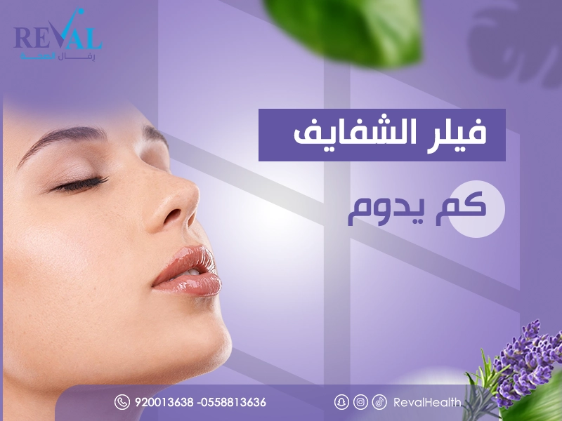 فيلر الشفايف كم يدوم؟ ومتى تظهر النتائج، وعوامل الحفاظ عليه مدة اطول
