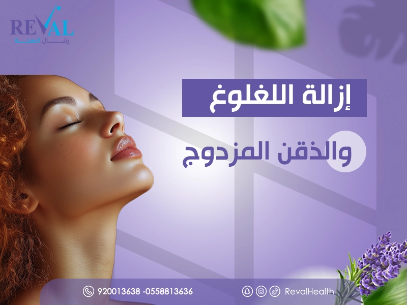 إزالة اللغلوغ والذقن المزدوج في الرياض بدون جراحة وبدون ألم