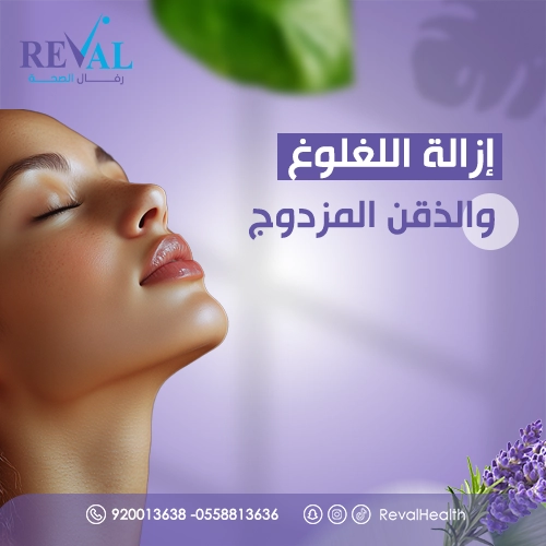 إزالة اللغلوغ والذقن المزدوج قبل وبعد