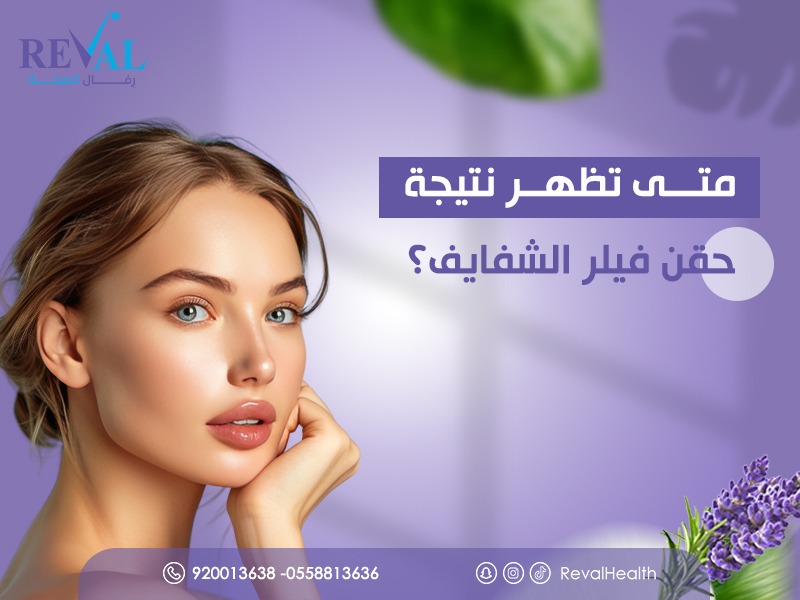 متى تظهر نتيجة حقن فيلر الشفايف؟