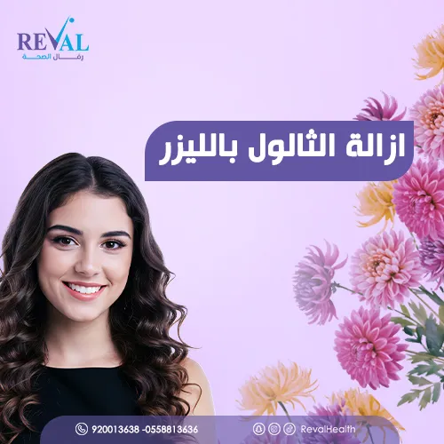تجربتي مع ازالة الثالول بالليزر