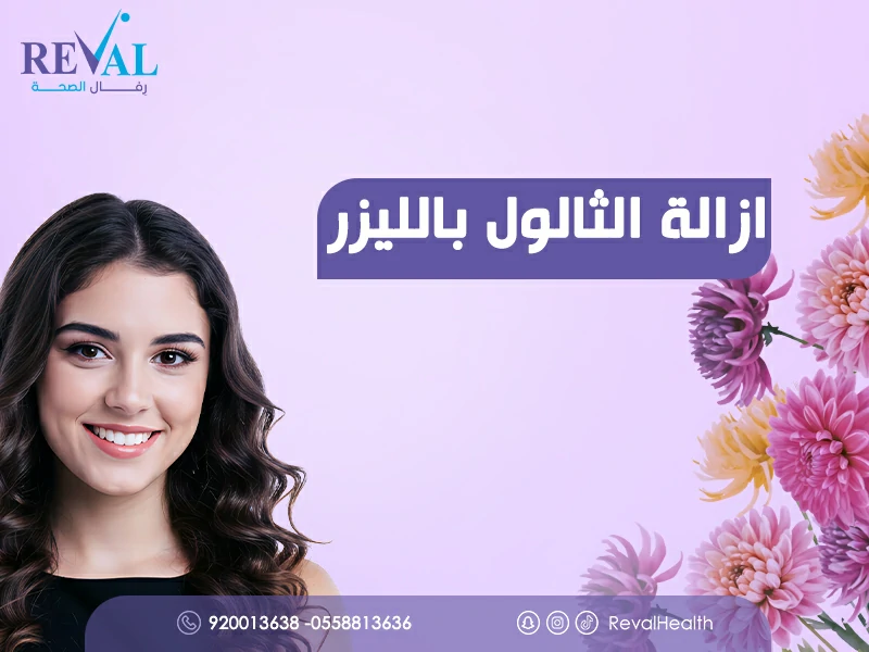 ازالة الثالول بالليزر: افضل عيادة إزالة الثآليل في اليرموك