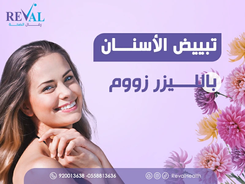 تبييض الأسنان بالليزر زووم في الرياض: اسرار تعرف عليها اولاً