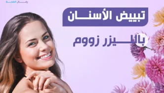 تبييض الأسنان بالليزر
