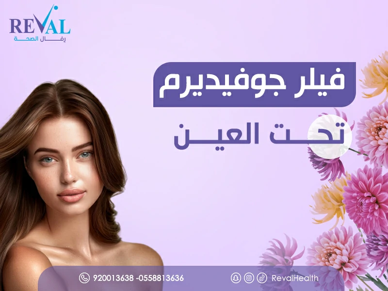 فيلر جوفيديرم تحت العين