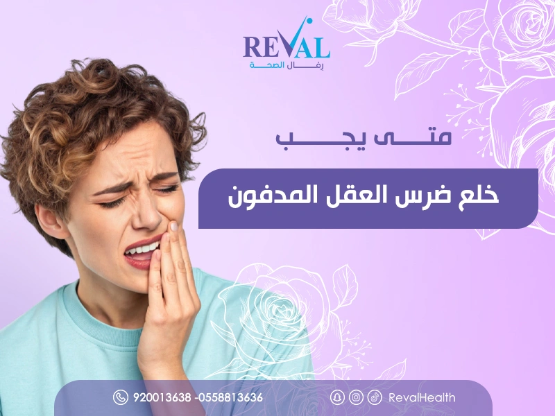 خلع ضرس العقل المدفون