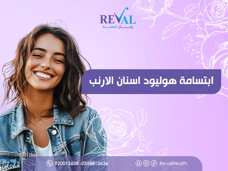 ابتسامة هوليود أسنان الأرنب: ما هي ولمن تصلح؟