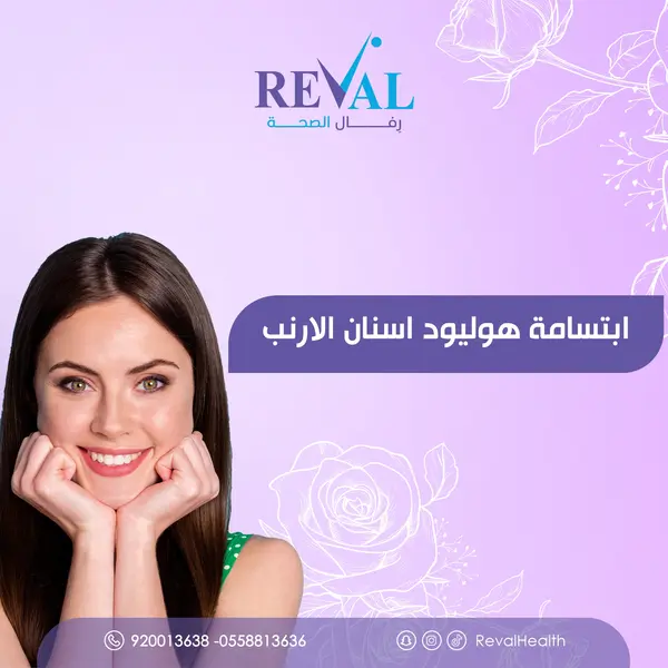 تجربتي مع ابتسامة هوليود أسنان الأرنب