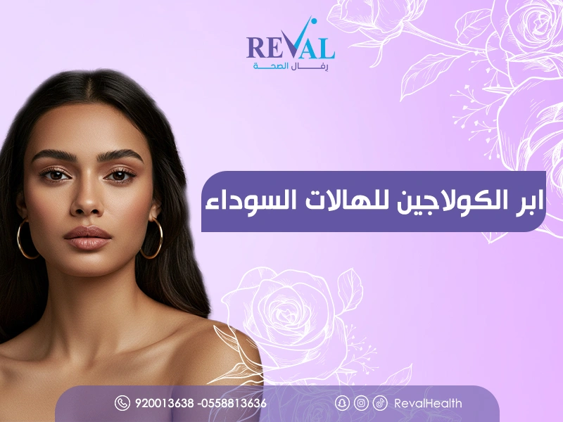 تجربتي مع ابر الكولاجين للهالات السوداء