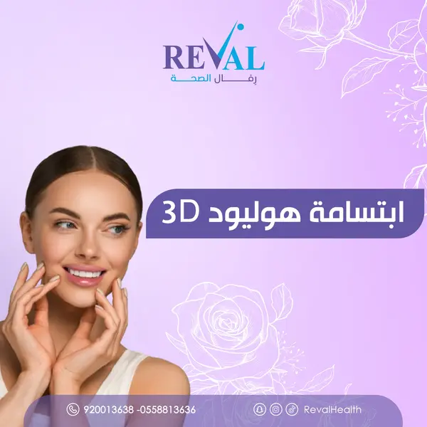 تجربتي مع ابتسامة هوليود 3D