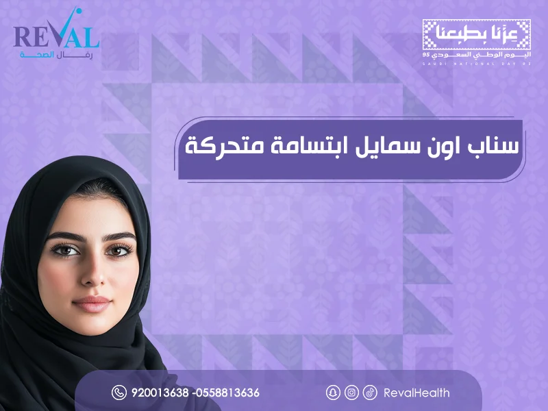 سناب أون سمايل ابتسامة متحركة بالرياض | ابتسامة هوليود بدون جراحة
