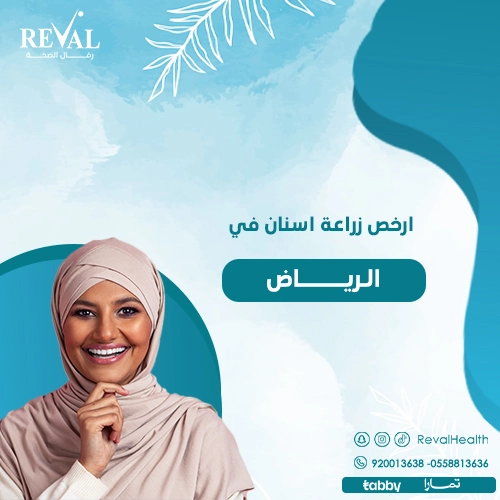تجربتي مع زراعة الأسنان في الرياض