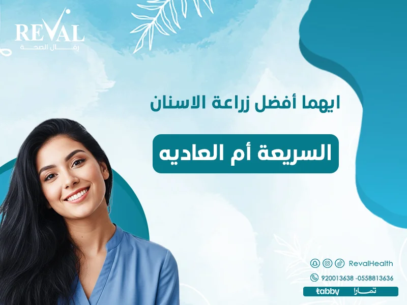 الفرق بين زراعة الأسنان السريعة والعادية: كيف تختار بين زراعة الاسنان الفورية والتقليدية