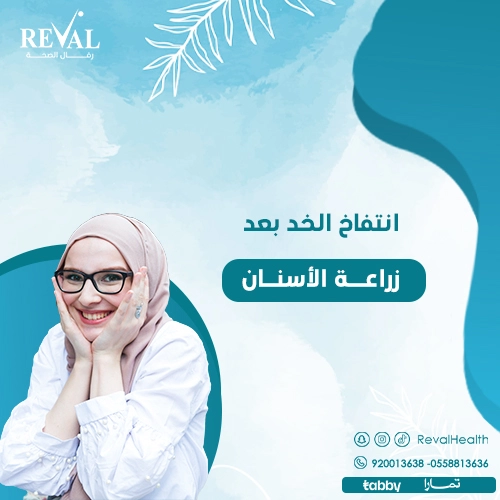 نصائح لتقليل تورم الوجه بعد زراعة الأسنان
