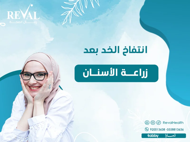 انتفاخ الخد بعد زراعة الأسنان: الأسباب، العلاج، والنصائح لتخفيف التورم ومدة استمرار تورم الوجه بعد زراعة الأسنان