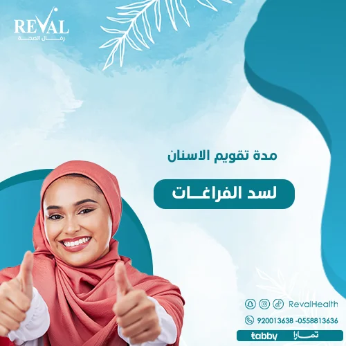 كم مدة تقويم الأسنان المتفرقة؟