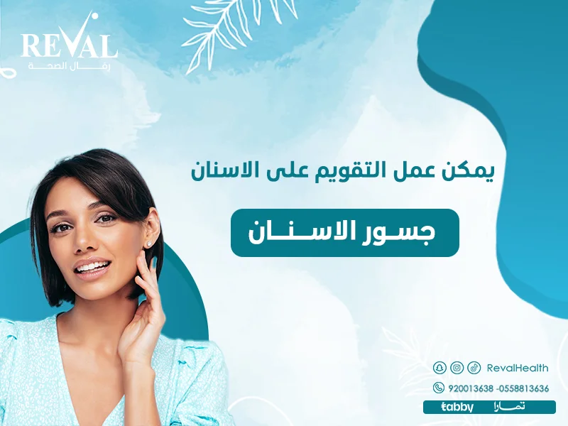 هل يمكن تركيب تقويم الأسنان في وجود جسور أو تيجان⁉️