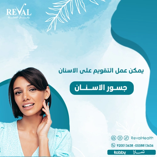 هل يمكن تركيب التقويم في وجود جسور أو تيجان⁉️