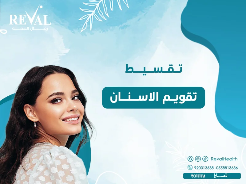 تقسيط تقويم الأسنان بالرياض | عروض التقويم بحي اليرموك