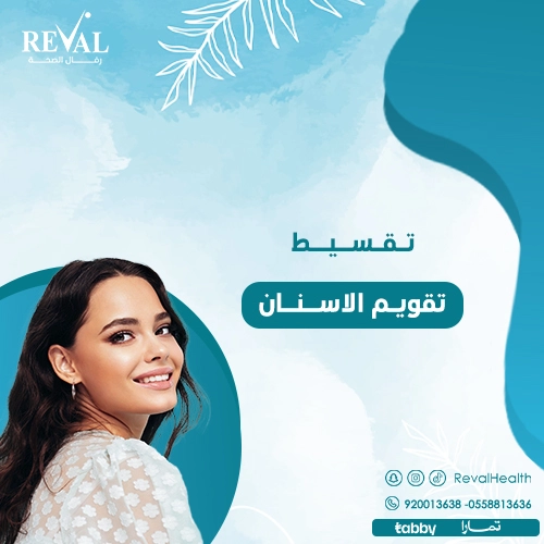 عيادات أسنان بالتقسيط في الرياض- أرخص سعر تقويم الأسنان في الرياض
