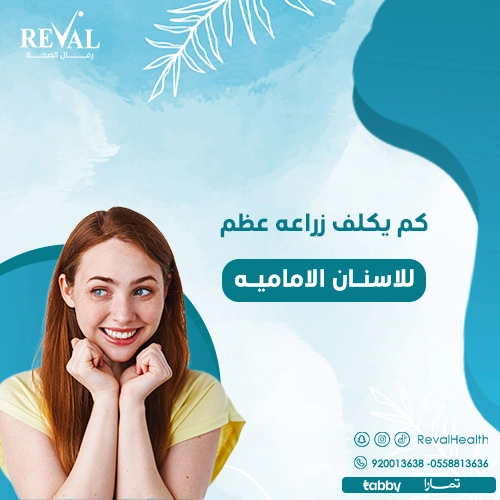 كم تكلف زراعة الأسنان في حي اليرموك بالرياض؟