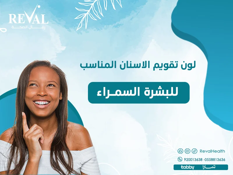 أفضل لون تقويم الأسنان للبشرة السمراء / كيف تختار انسب لون لبشرتك بالرياض⁉️