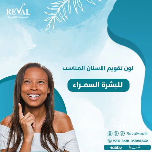 كيف تختار أفضل لون تقويم أسنان للبشرة السمراء؟