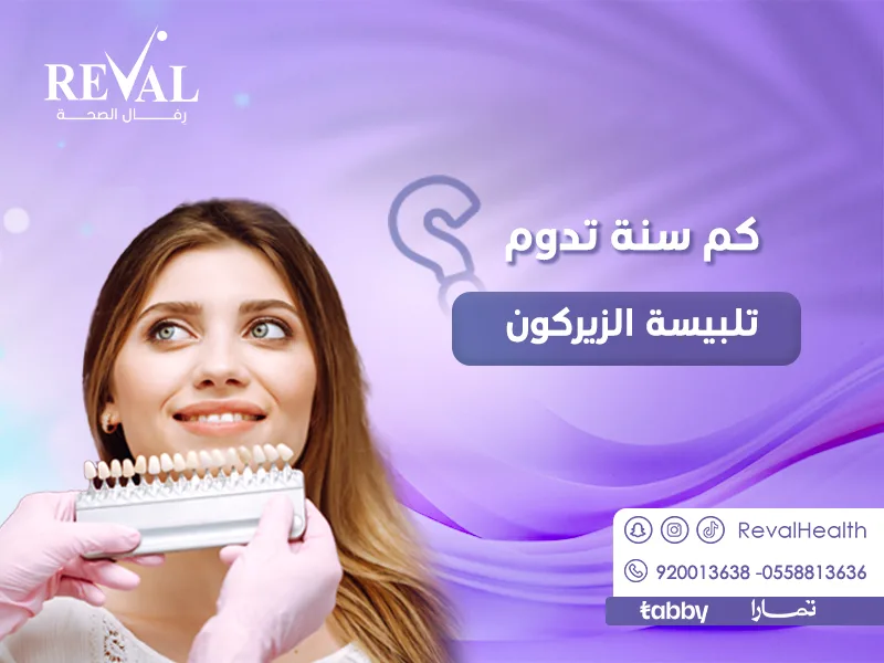 كم سنة تدوم تلبيسة الزيركون؟ هل يتغير لون تلبيسة الزيركون مع الوقت ⁉️