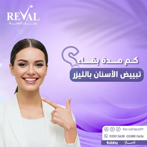 كيف تحافظ على نتائج تبييض الأسنان لأطول مدة؟