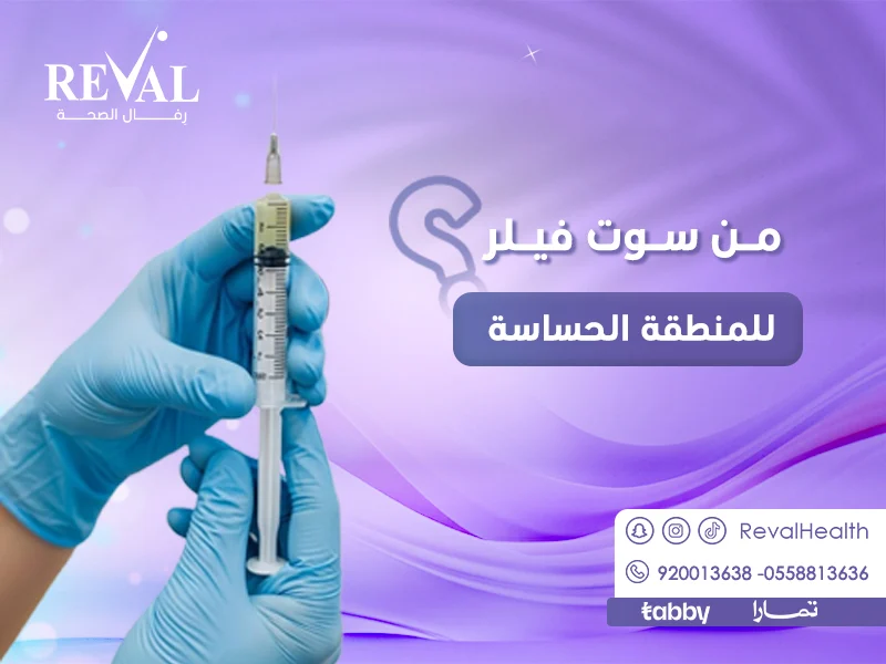 من سوت فيلر للمنطقة الحساسة/ هل يفتح الفيلر المناطق الحساسة