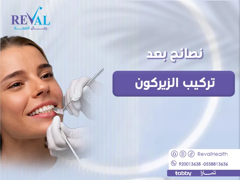نصائح بعد تركيب الزيركون