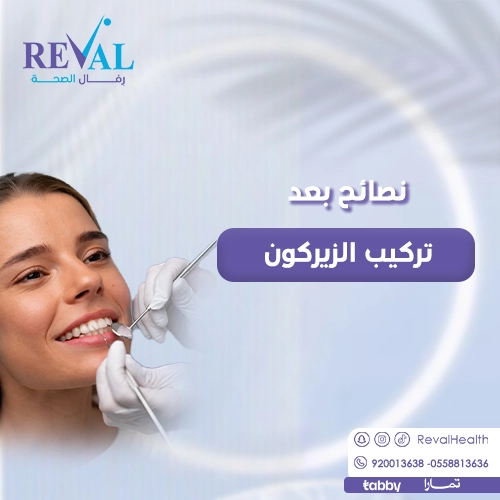 نصائح بعد تركيب الزيركون 