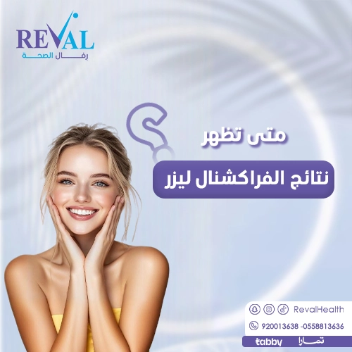 تجربتي مع الفراكشنال ليزر